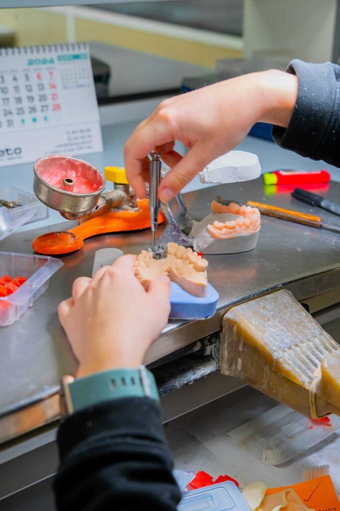 fabricantes-de-protesis-sobre-implantes-en-asturias