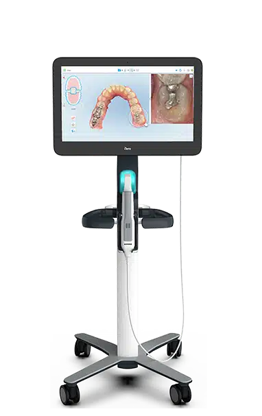 toma-impresion-digital-en-clinica-en-asturias